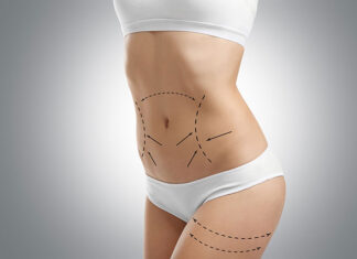 endermologia alliance Warszawa