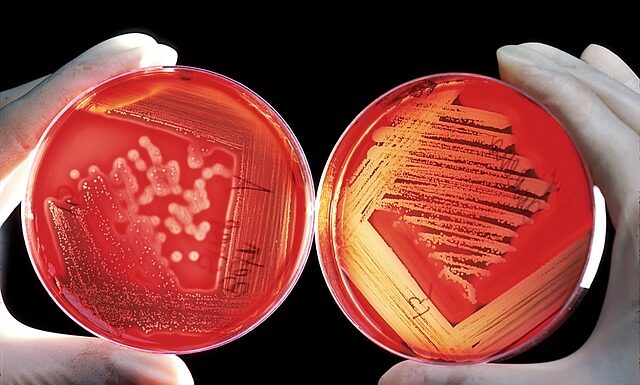 Jak zdjąć tipsy z klejem?